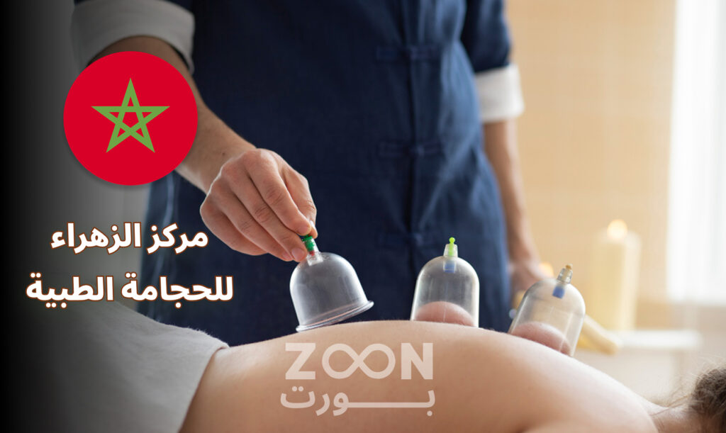 الزهراء